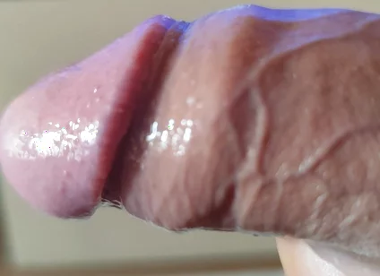 Strange Lumpy Cock with a Gigantic Head.