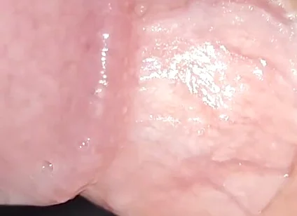 Incredible Cock, Unique of Slippery Phimosis by the Robust Body.