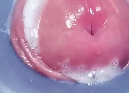Penis Machine with a New Attachment