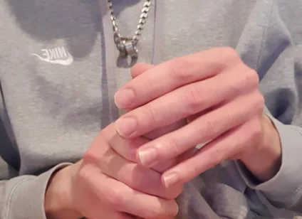 Skinny Lad Pulls Back Skin to Show Bellend