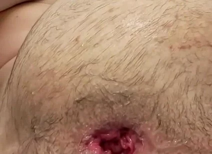 Teen Fisting Gaping Asshole Hard
