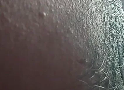 Armpit