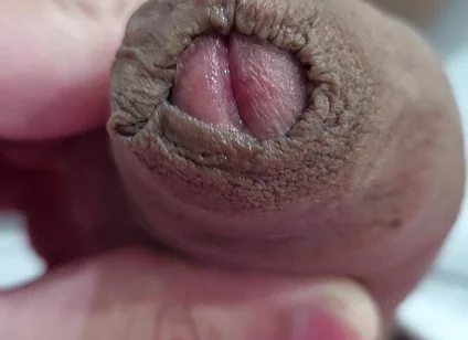 The Head of My Penis