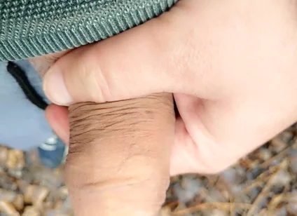 Cheesy Dirty Unwashed Cock Outdoor Walking Part 1