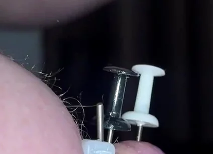 Thumtacks hurt
