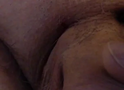 Limping Dick
