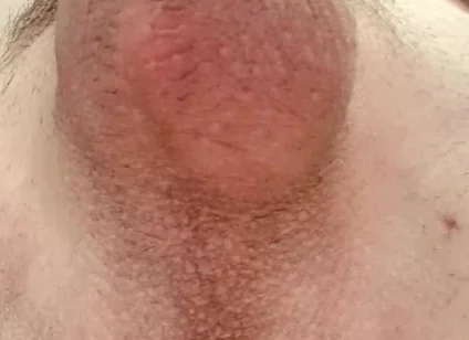 Do You Like Shaved or Hairy?