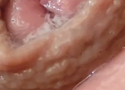 Juice From the Glans When Excited to the Extreme.
