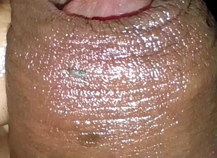 Close-up of Foreskin and Ejaculation in My Pants