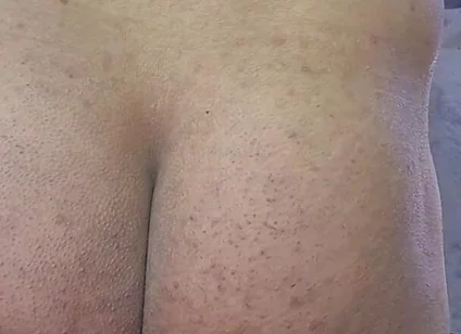 First Time Using an Inflatable Anal Ball