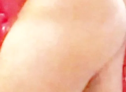 Whip-lash