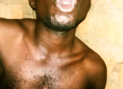My Great Massaging and Maculation