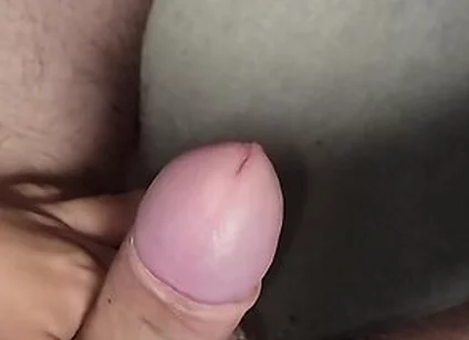I Slowly Masturbated The Phimosis