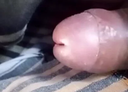 My Dick