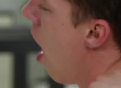 Exposed