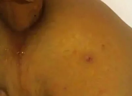 Deep in the Butt