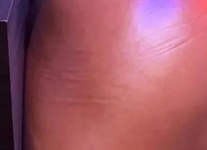 Bubble Butt