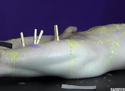 Pinching pegs leave welts