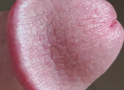 Closeup of Penis with One Vein