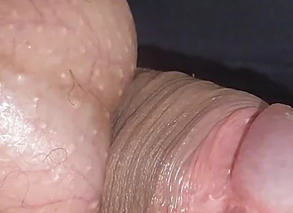 Amazing Upright Rough Venous Frenulum.