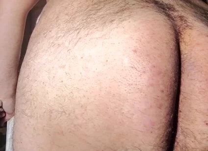 Fat Obese Butt