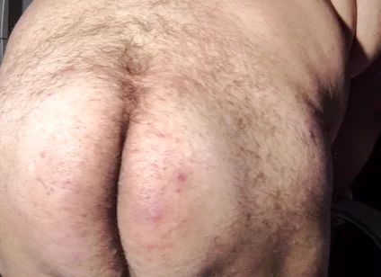 Fat Obese Butt