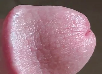 Closeup of Penis with One Vein
