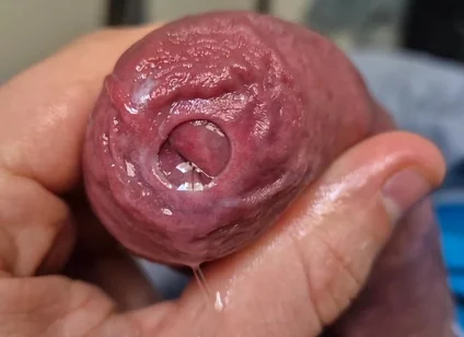 Uncut Head Precum Play