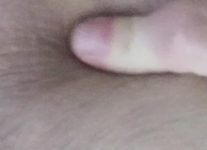 Dirty Anus