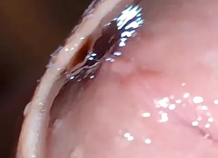 Glans Eye Watering After Intense Fucking.