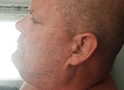 Renewed Destruction of the Bitch