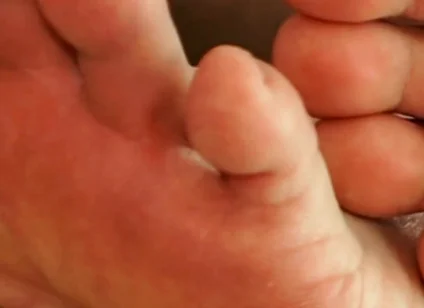 The Foot Master's Installation Protocol