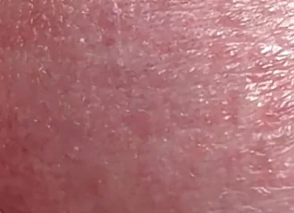 Sperm Close-up Front