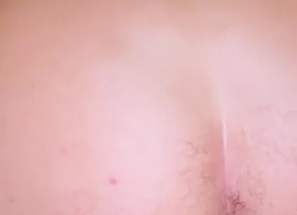 Losing My Anal Virginity