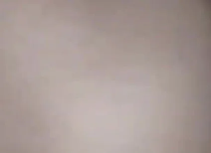Destroying the Asshole on the Dick