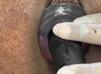 Ass Gape