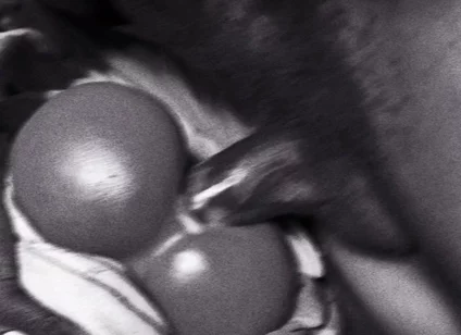Big Black Dick Interracial
