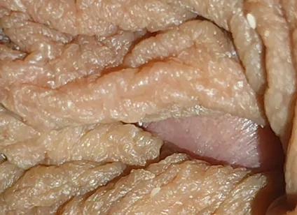 The World's Largest Foreskin Opening and Closing.