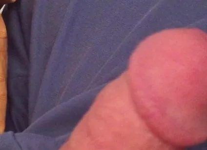 Surprise Dick