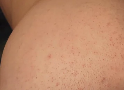 Big Black Dildo Fucks My Ass