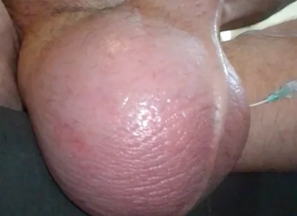 My Plump Juicy Watermelon Getting a Feeding