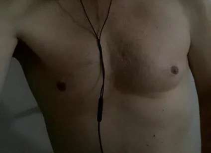Pectoralis and Frontal