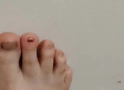 11-26-2025 Cute Little Toes