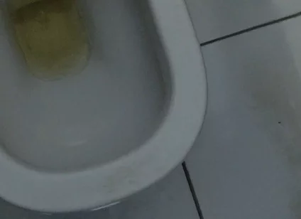 Homemade Method for Freezing the Penis