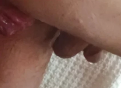 Prolapse and Urine