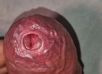 Close up on Phimosis Large Cock, so Hot!