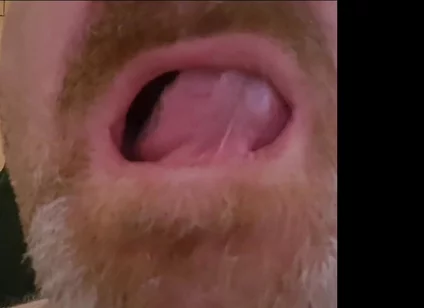Mature Chubby Bear Toothless. Watch Inside My Toothless Mouth and Meet My Tongue - Mouth Fetish