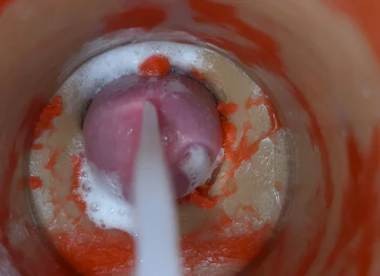 Insemination - Internal Camera Captures Deep Male Ejaculation