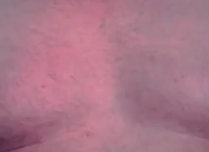 Brust Raus Nippel