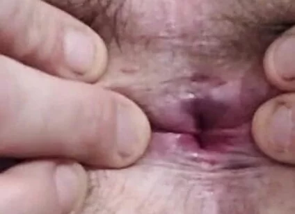 Closeup Asshole
